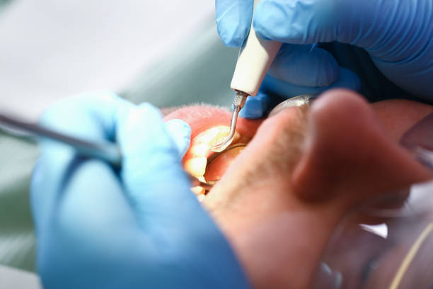 Best Mobile Emergency Dentist in Annapolis Neck, MD