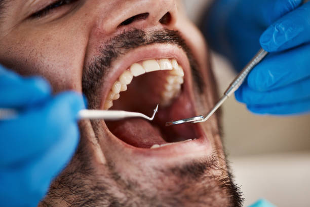 Best Mobile Emergency Dentist in Annapolis Neck, MD