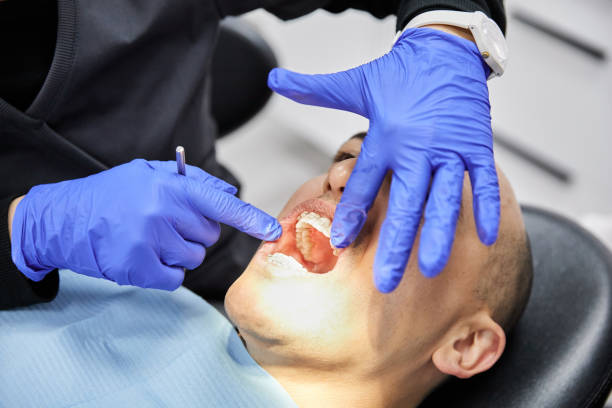 Best Emergency Dental Extractions in Annapolis Neck, MD